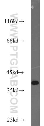 ZC3HAV1L Antibody in Western Blot (WB)