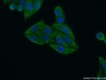 KIAA1984 Antibody in Immunocytochemistry (ICC/IF)