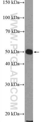 KIAA1984 Antibody in Western Blot (WB)