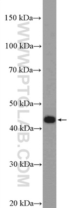 KIAA1984 Antibody in Western Blot (WB)