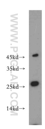 ABHD14B Antibody in Western Blot (WB)