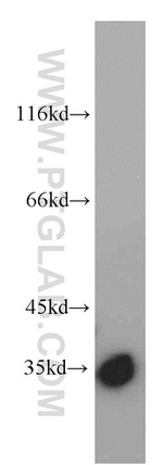 PYCR1 Antibody in Western Blot (WB)