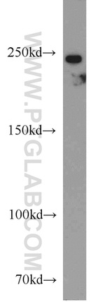F5 Antibody in Western Blot (WB)