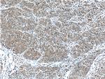 F5 Antibody in Immunohistochemistry (Paraffin) (IHC (P))
