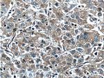 F5 Antibody in Immunohistochemistry (Paraffin) (IHC (P))