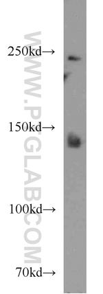 F5 Antibody in Western Blot (WB)