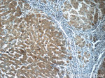 CYP11B2 Antibody in Immunohistochemistry (Paraffin) (IHC (P))