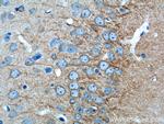 CACNG2 Antibody in Immunohistochemistry (Paraffin) (IHC (P))