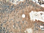 CAPN8 Antibody in Immunohistochemistry (Paraffin) (IHC (P))