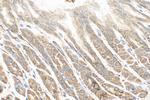 CAPN8 Antibody in Immunohistochemistry (Paraffin) (IHC (P))
