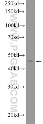 HB9 Antibody in Western Blot (WB)