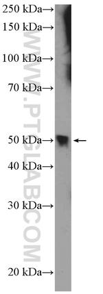 HB9 Antibody in Western Blot (WB)