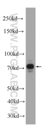 NR2C2 Antibody in Western Blot (WB)