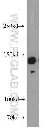 BRIP1 Antibody in Western Blot (WB)
