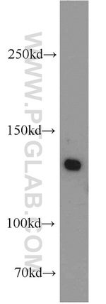 BRIP1 Antibody in Western Blot (WB)