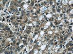 DEPDC6/Deptor Antibody in Immunohistochemistry (Paraffin) (IHC (P))