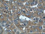 DEPDC6/Deptor Antibody in Immunohistochemistry (Paraffin) (IHC (P))