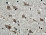 TRPV4 Antibody in Immunohistochemistry (Paraffin) (IHC (P))