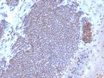 Estrogen Receptor, alpha (Marker of Estrogen Dependence) Monoclonal Antibody (ESR1/3373), Biotin