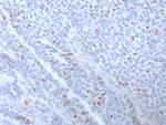 Estrogen Receptor, alpha (Marker of Estrogen Dependence) Monoclonal Antibody (ESR1/3373)