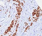 Estrogen Receptor, alpha (Marker of Estrogen Dependence) Antibody in Immunohistochemistry (Paraffin) (IHC (P))