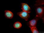 Cyclin T1 Antibody in Immunocytochemistry (ICC/IF)