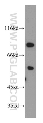 Cyclin T1 Antibody in Western Blot (WB)
