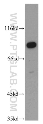 Cyclin T1 Antibody in Western Blot (WB)