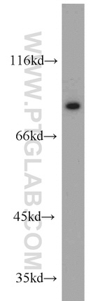 Cyclin T1 Antibody in Western Blot (WB)