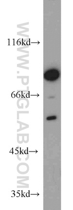 Cyclin T1 Antibody in Western Blot (WB)