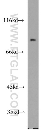 Cyclin T1 Antibody in Western Blot (WB)