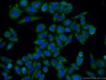 TMEM106B Antibody in Immunocytochemistry (ICC/IF)