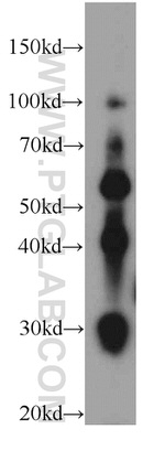 TMEM106B Antibody in Western Blot (WB)