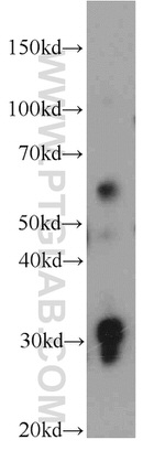 TMEM106B Antibody in Western Blot (WB)