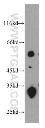 TMEM106B Antibody in Western Blot (WB)