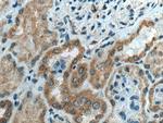TMEM61 Antibody in Immunohistochemistry (Paraffin) (IHC (P))