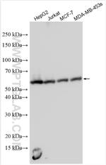 JMJD5 Antibody in Western Blot (WB)