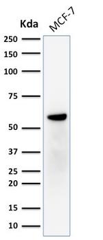 ER-beta-1 (Estrogen Receptor beta-1) Antibody in Western Blot (WB)