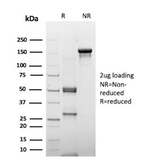 ER-beta (Estrogen Receptor beta-2) Antibody in SDS-PAGE (SDS-PAGE)
