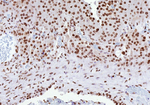 ER-beta (Estrogen Receptor beta-2) Antibody in Immunohistochemistry (Paraffin) (IHC (P))