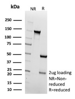 ER-beta (Estrogen Receptor beta-2) Antibody in SDS-PAGE (SDS-PAGE)
