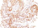 ER-beta-1 (Estrogen Receptor beta-1) Antibody in Immunohistochemistry (Paraffin) (IHC (P))