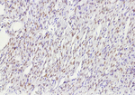 ER-beta (Estrogen Receptor beta-2) Antibody in Immunohistochemistry (Paraffin) (IHC (P))