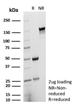 ER-beta (Estrogen Receptor beta-2) Antibody in SDS-PAGE (SDS-PAGE)