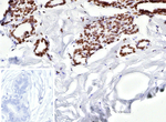 ER-beta (Estrogen Receptor beta-2) Monoclonal Antibody (ESR2/9710)