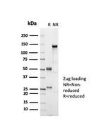 ER-beta-1 (Estrogen Receptor beta-1) Recombinant Rabbit Monoclonal Antibody (ESR2/7006R)