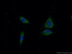OTUD5 Antibody in Immunocytochemistry (ICC/IF)