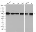 OTUD5 Antibody in Western Blot (WB)