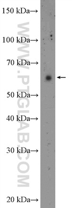 OTUD5 Antibody in Western Blot (WB)