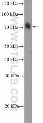 OTUD5 Antibody in Western Blot (WB)